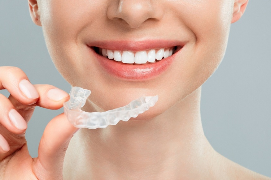 Invisalign Treatment Process