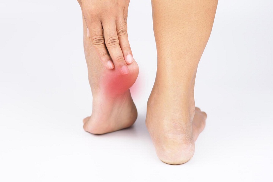 Treating Plantar Fasciitis Pain